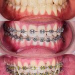 Great Smile Dental Melaka 微美牙科.马六甲牙医