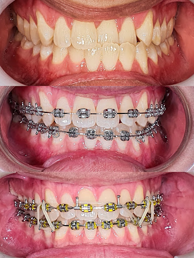 Great Smile Dental Melaka 微美牙科.马六甲牙医