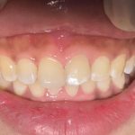 Happy teeth 2 dental surgery