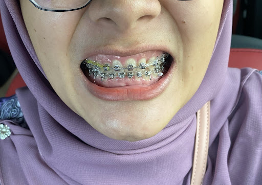 i-smile ( TOWN SQUARE ) Dental Surgery Bintulu