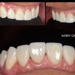 Ivory Care Dental Clinic • Bukit Mertajam