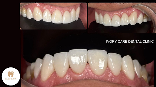 Ivory Care Dental Clinic • Bukit Mertajam