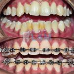 Klinik Gigi PJ L&M(Dr MeiLuk Braces Petaling Jaya)