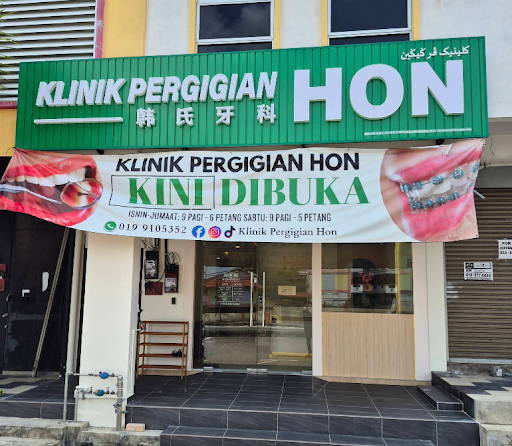 Klinik Ortodontik Terbaik yang Pakar dalam Pendakap Gigi di Mentekab