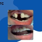 Klinik Pergigian Al-Huda Bandar Kuantan Braces, Veneer & Rawatan Akar
