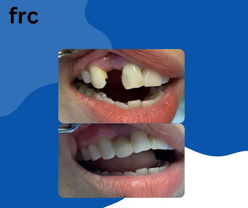 Klinik Pergigian Al-Huda Bandar Kuantan Braces, Veneer & Rawatan Akar