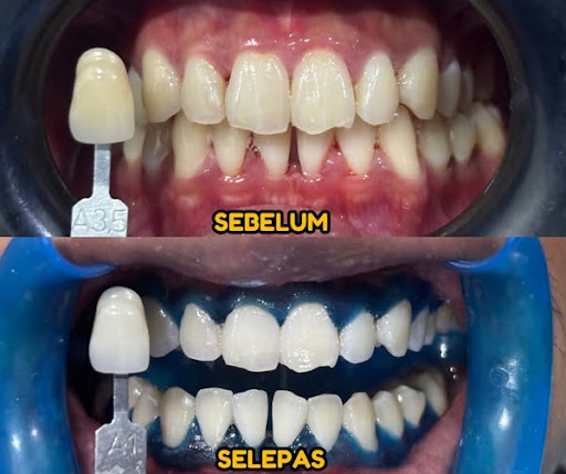 Klinik Pergigian Al-Huda Kampung Padang Braces & Veneer