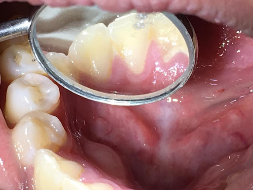 Klinik Pergigian Bite