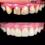 Klinik Pergigian Dentalane Alam Damai (Orthodontist, Braces & Aligners)