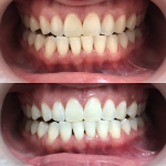 Klinik Pergigian Dr. Chong & Co. (Chong Dental Clinic / Klinik Pergigian Chong)