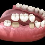 Klinik Pergigian Dr Fatain - Aesthetic, Veneer & Braces @ Taman Tas, Kuantan
