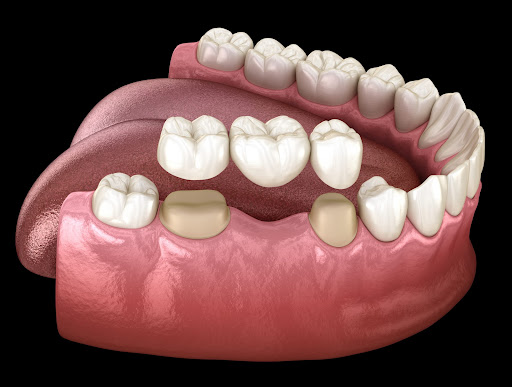 Klinik Pergigian Dr Fatain - Aesthetic, Veneer & Braces @ Taman Tas, Kuantan