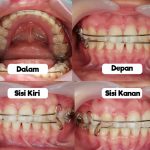 KLINIK PERGIGIAN GLOWSMILE SEBERANG JAYA