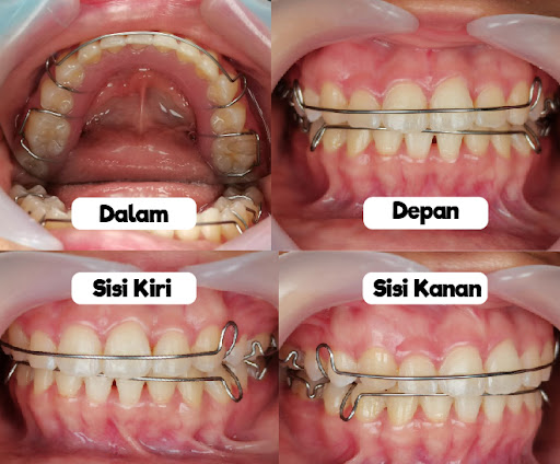 KLINIK PERGIGIAN GLOWSMILE SEBERANG JAYA