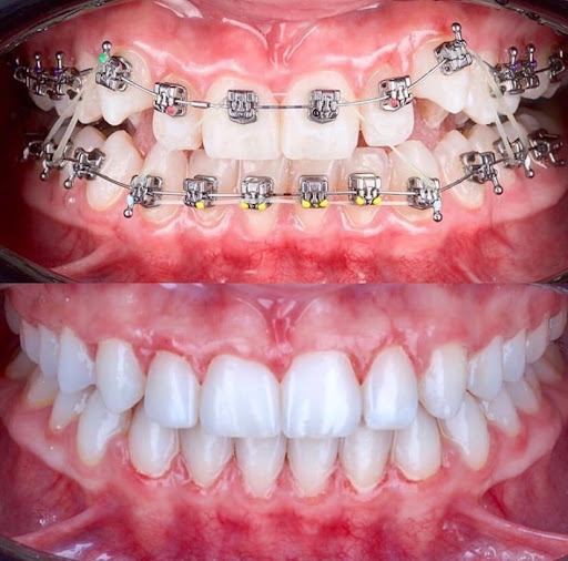 Klinik Pergigian Happy Dental