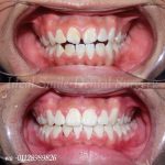 Klinik Pergigian Ideal Smile Dental Kulim