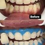 Klinik Pergigian Myne Dental @ Nilai