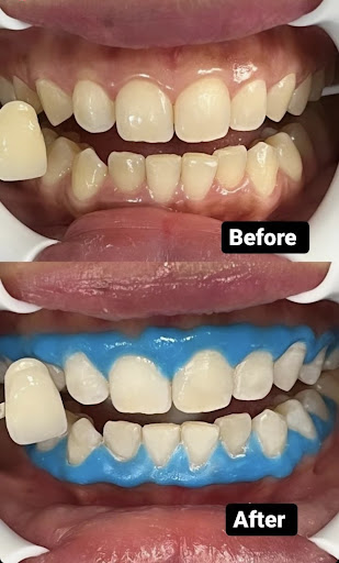 Klinik Pergigian Myne Dental @ Nilai