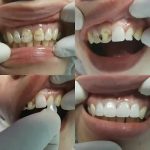 Klinik Pergigian Pelabuhan