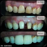 Klinik Pergigian Sanchez(Clear Aligners Provider)