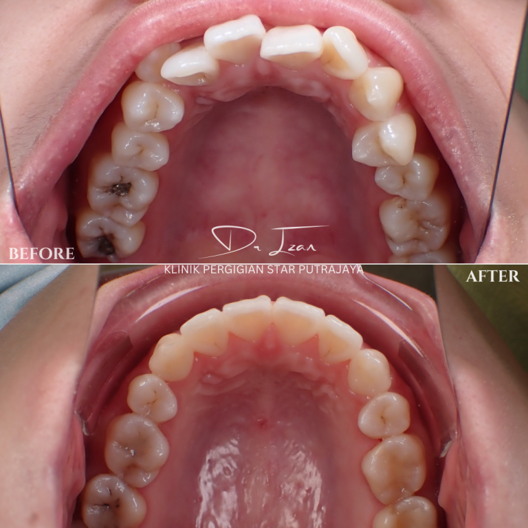 Klinik Pergigian Star (Dentist Putrajaya)