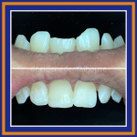 Klinik Pergigian The Dental House Putera Indah | Parit Yani | Batu Pahat| Johor | SCALING | TAMPAL GIGI | BRACES | GIGI PALSU