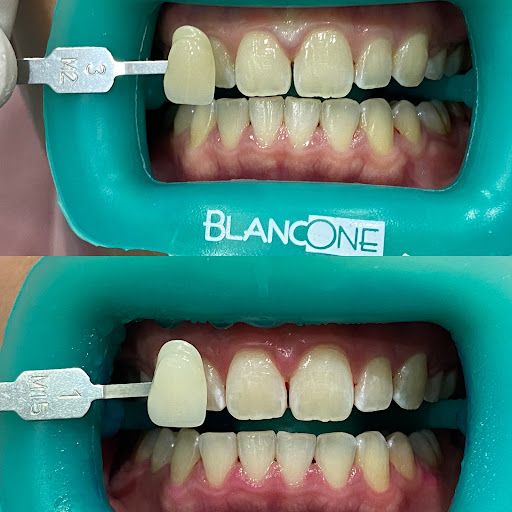 Klinik Pergigian TN Smile Dental