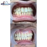 Klinik Pergigian U.n.i dental Pasir Gudang