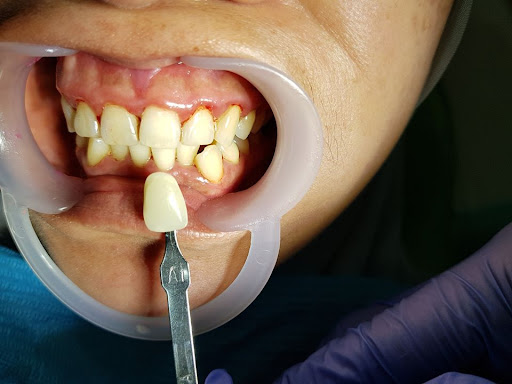 Klinik Pergigian Way2smile (IMPLANT ,GUM SURGERY & BRACES IPOH CENTRE)