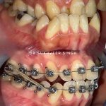 Singh Dental Clinic , Klinik Pergigian Singh Dental ( Braces , Invisalign , Comfortable Dental Experience )