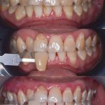 Smile Up Dental Puchong (Implant & Braces Specialist Center)