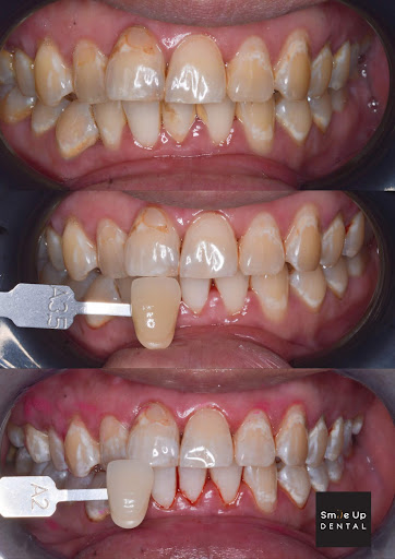 Smile Up Dental Puchong (Implant & Braces Specialist Center)