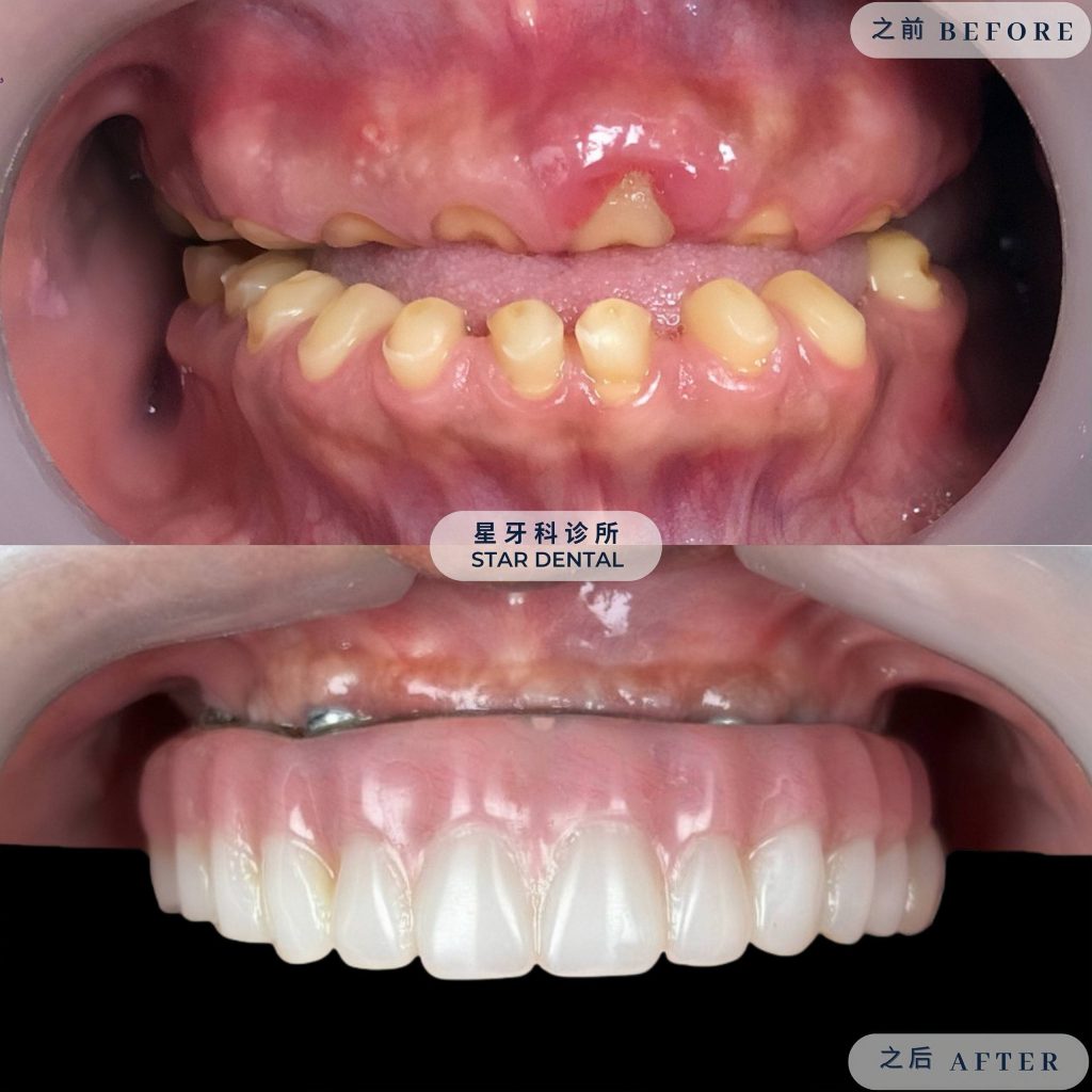 Star Dental Clinic Bukit Mertajam - Implant & Braces Centre 大山脚星牙科 种植牙和绑牙中心